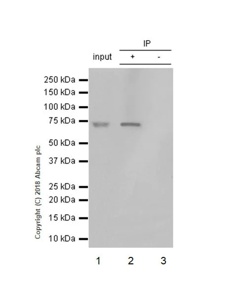 Immunoprecipitation - Anti-MMP2 antibody [EPR17003-25] - BSA and Azide free (AB250476)