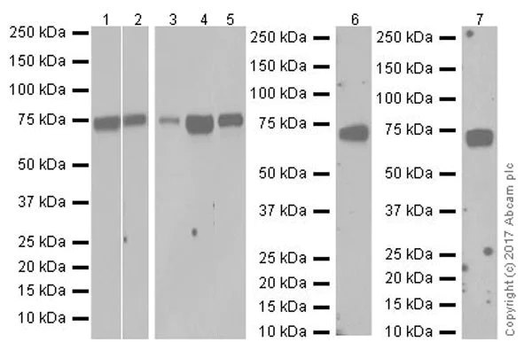 Western blot - Anti-MMP2 antibody [EPR17003-25] - BSA and Azide free (AB250476)
