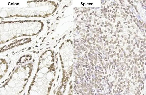 Immunohistochemistry paraffin embedded sections - Anti-MMP2 antibody [HL1207] (AB308346)