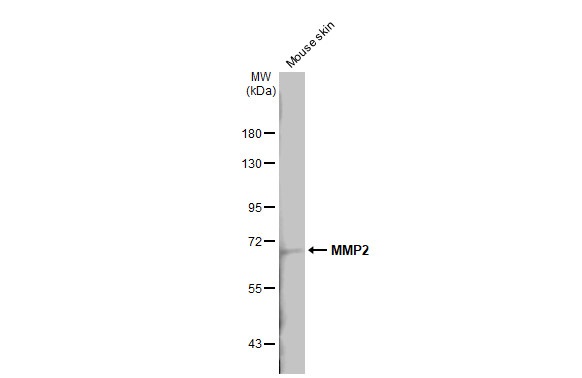 Western blot - Anti-MMP2 antibody [HL1207] (AB308346), expandable thumbnail