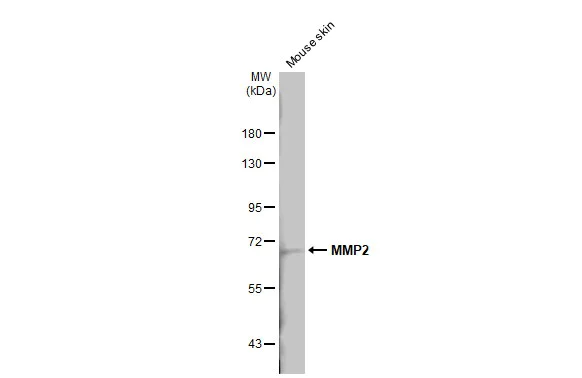 Western blot - Anti-MMP2 antibody [HL1207] (AB308346)