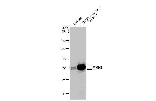 Western blot - Anti-MMP2 antibody [HL1207] (AB308346), expandable thumbnail
