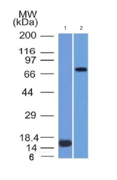 Western blot - Anti-MMP2 antibody [MMP2/1501] (AB218462)