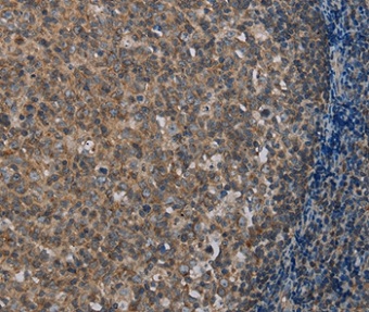 Immunohistochemistry (Formalin/PFA-fixed paraffin-embedded sections) - Anti-MMP20 antibody (AB198815)