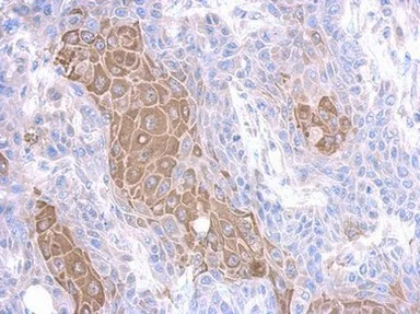 Immunohistochemistry (Formalin/PFA-fixed paraffin-embedded sections) - Anti-MMP23 antibody (AB155416)