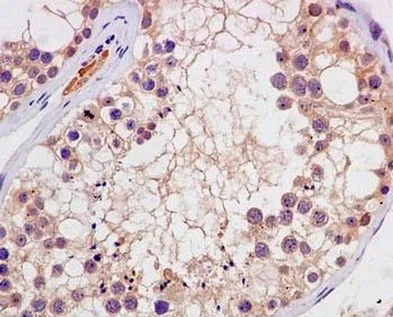 Immunohistochemistry (Formalin/PFA-fixed paraffin-embedded sections) - Anti-MMP23 antibody [EPR7769] (AB181118)
