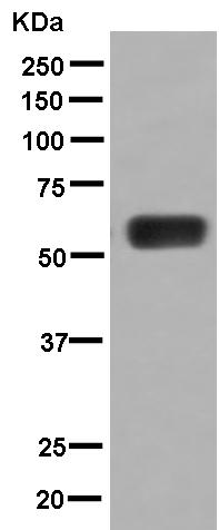 Western blot - Anti-MMP23 antibody [EPR7769] (AB181118), expandable thumbnail