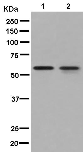 Western blot - Anti-MMP23 antibody [EPR7769] (AB181118), expandable thumbnail