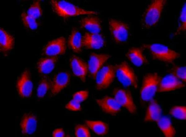 Immunocytochemistry/ Immunofluorescence - Anti-MMP23 antibody [EPR7769] - BSA and Azide free (AB250359)