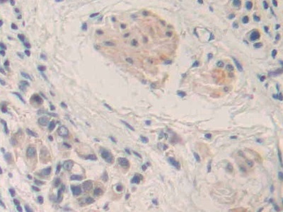 Immunohistochemistry (Formalin/PFA-fixed paraffin-embedded sections) - Anti-MMP24 antibody (AB233004)