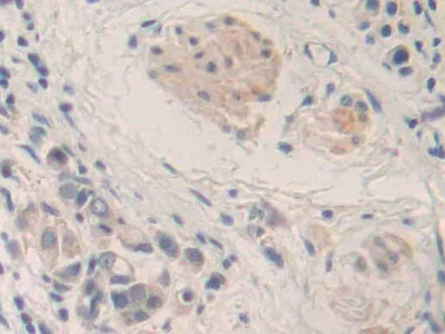 Immunohistochemistry (Formalin/PFA-fixed paraffin-embedded sections) - Anti-MMP24 antibody (AB233004)