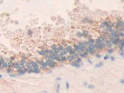 Immunohistochemistry (Formalin/PFA-fixed paraffin-embedded sections) - Anti-MMP24 antibody (AB233004)