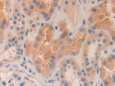 Immunohistochemistry (Formalin/PFA-fixed paraffin-embedded sections) - Anti-MMP24 antibody (AB233004)