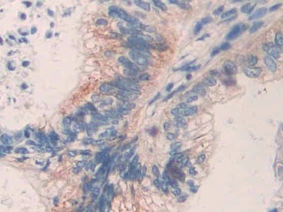 Immunohistochemistry (Formalin/PFA-fixed paraffin-embedded sections) - Anti-MMP24 antibody (AB233004)