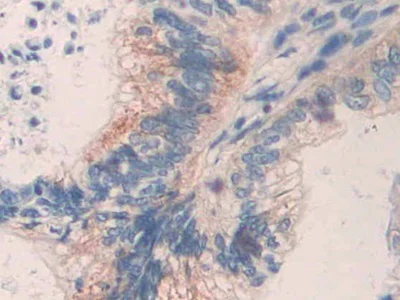 Immunohistochemistry (Formalin/PFA-fixed paraffin-embedded sections) - Anti-MMP24 antibody (AB233004)