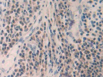 Immunohistochemistry (Formalin/PFA-fixed paraffin-embedded sections) - Anti-MMP24 antibody (AB233004)