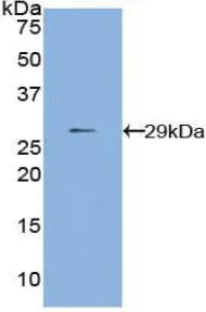 Western blot - Anti-MMP24 antibody (AB233004)