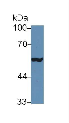 Western blot - Anti-MMP24 antibody (AB233004)