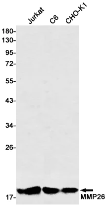 Western blot - Anti-MMP26 Antibody [S01-7A4] (AB317391)
