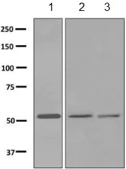Western blot - Anti-MMP27 antibody [EPR7543] (AB150415)