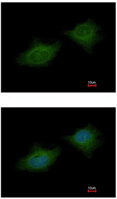 Immunocytochemistry/ Immunofluorescence - Anti-MMP3 antibody (AB137659)