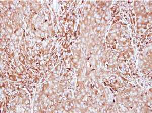 Immunohistochemistry (Formalin/PFA-fixed paraffin-embedded sections) - Anti-MMP3 antibody (AB137659)