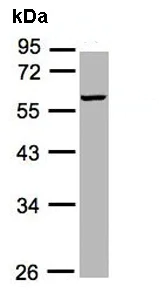 Western blot - Anti-MMP3 antibody (AB137659)