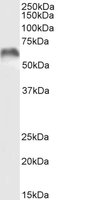 Western blot - Anti-MMP3 antibody (AB223666), expandable thumbnail