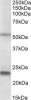 Western blot - Anti-MMP3 antibody (AB223666), expandable thumbnail