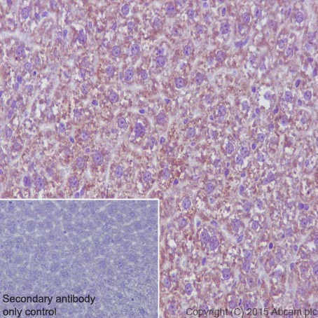 Immunohistochemistry (Formalin/PFA-fixed paraffin-embedded sections) - Anti-MMP3 antibody [EP1186Y] (AB52915)