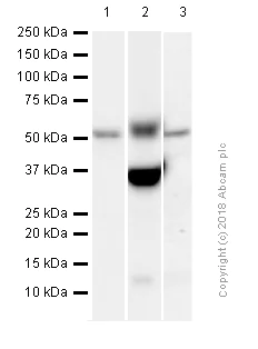 Western blot - Anti-MMP3 antibody [EP1186Y] (AB52915)