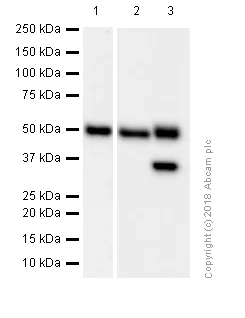 Western blot - Anti-MMP3 antibody [EP1186Y] (AB52915)