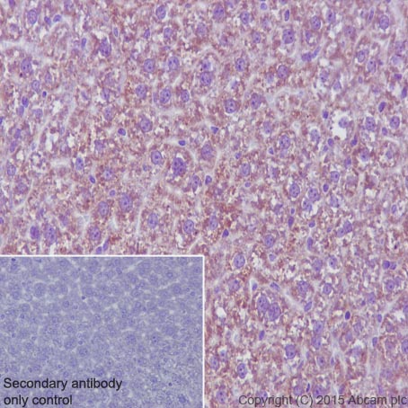 Immunohistochemistry (Formalin/PFA-fixed paraffin-embedded sections) - Anti-MMP3 antibody [EP1186Y] - BSA and Azide free (AB214794), expandable thumbnail