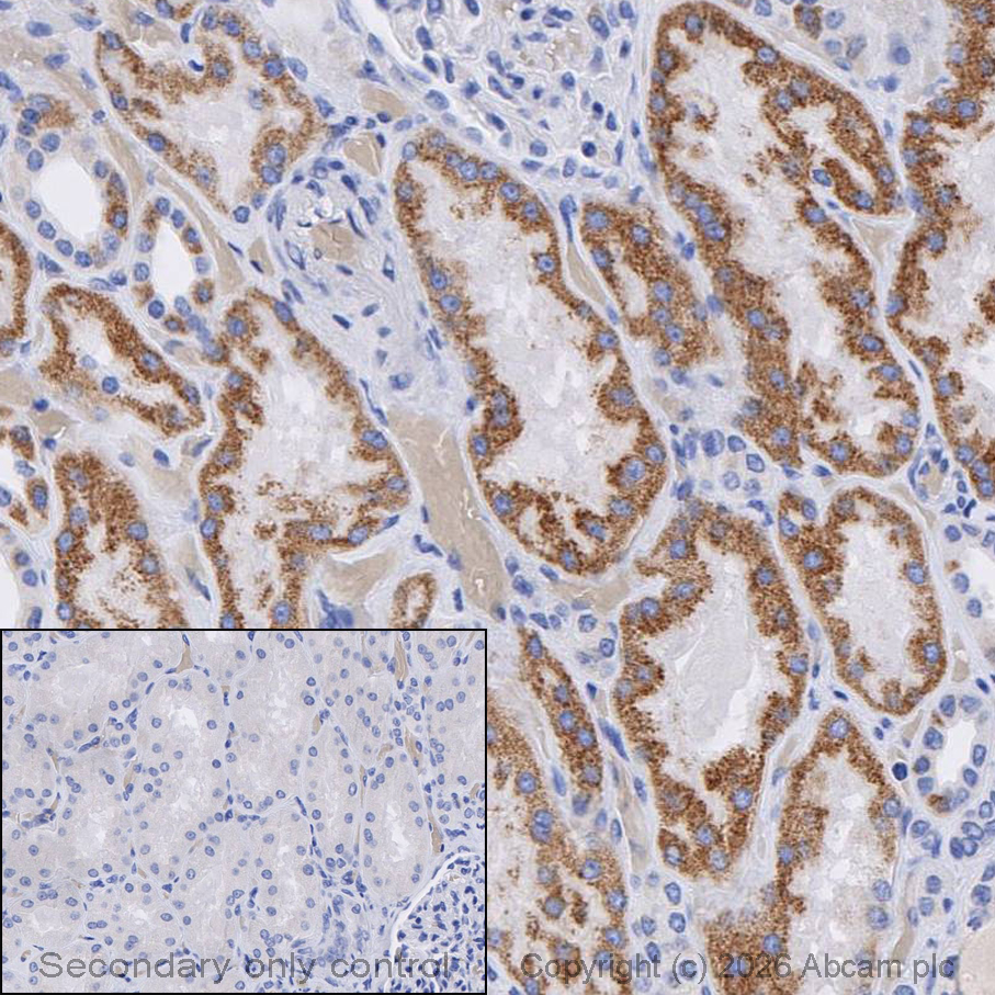 Immunohistochemistry (Formalin/PFA-fixed paraffin-embedded sections) - Anti-MMP3 antibody [EP1186Y] - BSA and Azide free (AB214794)