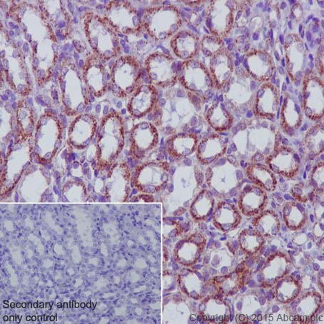 Immunohistochemistry (Formalin/PFA-fixed paraffin-embedded sections) - Anti-MMP3 antibody [EP1186Y] - BSA and Azide free (AB214794), expandable thumbnail