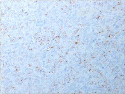 Immunohistochemistry (Formalin/PFA-fixed paraffin-embedded sections) - Anti-MMP3 antibody [MMP3/1994R] (AB234310)