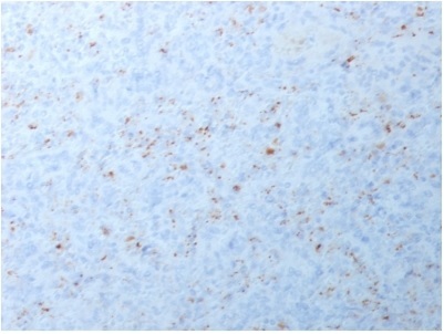 Immunohistochemistry (Formalin/PFA-fixed paraffin-embedded sections) - Anti-MMP3 antibody [MMP3/1994R] - BSA and Azide free (AB236305), expandable thumbnail