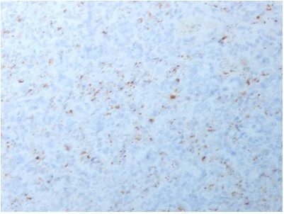 Immunohistochemistry (Formalin/PFA-fixed paraffin-embedded sections) - Anti-MMP3 antibody [MMP3/1994R] - BSA and Azide free (AB236305)