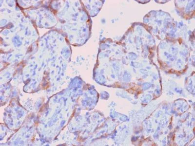 Immunohistochemistry (Formalin/PFA-fixed paraffin-embedded sections) - Anti-MMP3 antibody [rMMP3/1730] (AB234405)