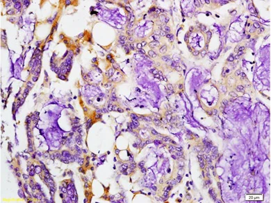 Immunohistochemistry (Formalin/PFA-fixed paraffin-embedded sections) - Anti-MMP7 antibody (AB216631)