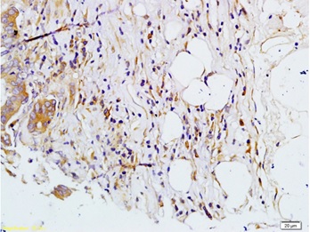 Immunohistochemistry (Formalin/PFA-fixed paraffin-embedded sections) - Anti-MMP7 antibody (AB216631)