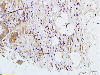 Immunohistochemistry (Formalin/PFA-fixed paraffin-embedded sections) - Anti-MMP7 antibody (AB216631)