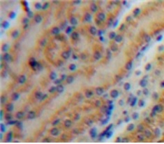 Immunohistochemistry (Formalin/PFA-fixed paraffin-embedded sections) - Anti-MMP7 antibody (AB232737)