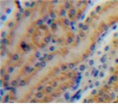 Immunohistochemistry (Formalin/PFA-fixed paraffin-embedded sections) - Anti-MMP7 antibody (AB232737)