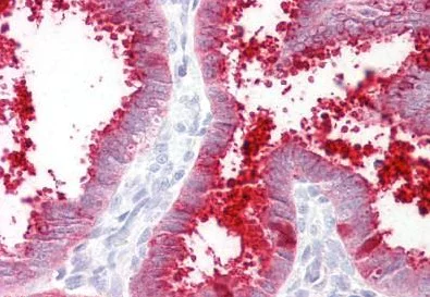Immunohistochemistry (Formalin/PFA-fixed paraffin-embedded sections) - Anti-MMP7 antibody - C-terminal (AB189277)