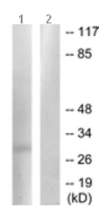 Western blot - Anti-MMP7 antibody - C-terminal (AB189277)
