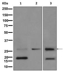 Western blot - Anti-MMP7 antibody [EPR1251(2)] (AB176325), expandable thumbnail