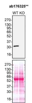 Western blot - Anti-MMP7 antibody [EPR1251(2)] (AB176325)