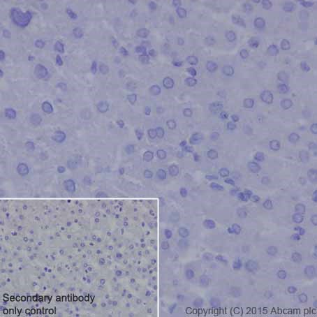 Immunohistochemistry (Formalin/PFA-fixed paraffin-embedded sections) - Anti-MMP7 antibody [EPR17888-101] (ab205525), expandable thumbnail