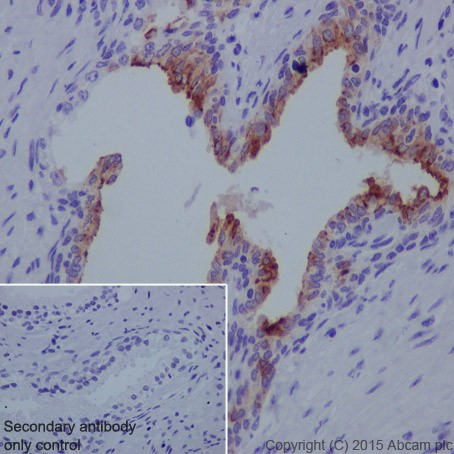 Immunohistochemistry (Formalin/PFA-fixed paraffin-embedded sections) - Anti-MMP7 antibody [EPR17888-101] (AB205525), expandable thumbnail